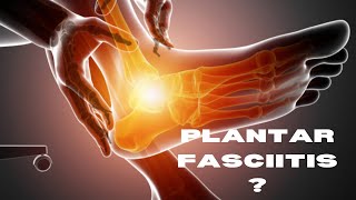 Plantar Fasciitis Causes Symptoms and Treatment [upl. by Ased951]