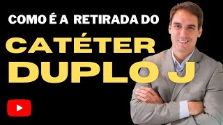 Como é a retirada de Catéter Duplo J [upl. by Llevrac]