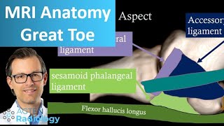 Great toe MRI Anatomy  First metatarsophalangeal joint [upl. by Yadsendew635]