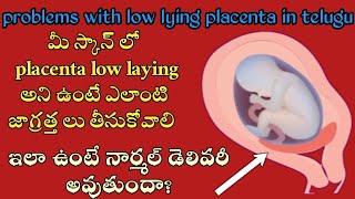 low lying placenta in telugu  anterior low lying placenta in telugu  prblm with low lying placenta [upl. by Bates]