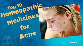 Top 10 Homeopathic medicines for Acne Acne vulgaris amp rosacea [upl. by Eiramaliehs]