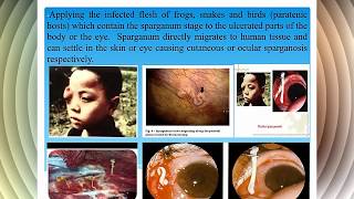 4Cestodes vet  DiphyllothriumTaenia [upl. by Irat]