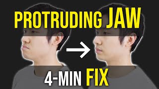 Protruding Jaw  Underbite Fix ｜Facial Asymmetry Correction｜Corrective Exercises [upl. by Graf]