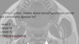 RETROPHARYNGEAL NODESNODES OF ROUVIERE [upl. by Beauvais]