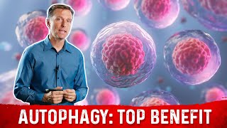 The Most Important Benefit of Autophagy Will Surprise You [upl. by Aicak]