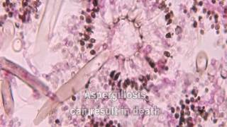 Aspergillus and Aspergillosis [upl. by Edwyna]