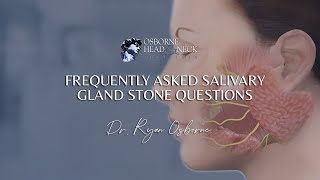 Salivary Gland Stones Frequently Asked Questions by Expert Surgeon Dr Ryan Osborne [upl. by Marolda]