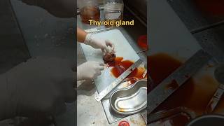 Cystic thyroid gland gross pathology [upl. by Nnaitak616]