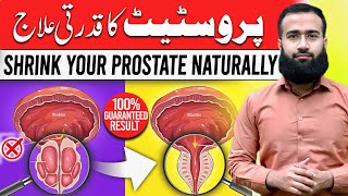 Shrink Prostate Naturally  Remedy for Healthy Prostate [upl. by Uhthna191]