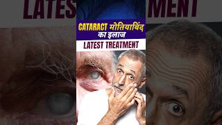 Cataract मोतियाबिंद का इलाज [upl. by Calabrese]