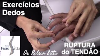 EXERCÍCIOS DEDOS RUPTURA TENDÃO EXTENSOR PÓS OPERATÓRIO Clínica Fisioterapia Dr Robson Sitta [upl. by Eleda197]