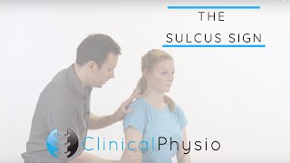 Sulcus Sign  Clinical Physio [upl. by Andy]