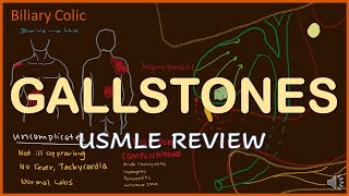 Gallstones Review for USMLE 13 [upl. by Adnarem]