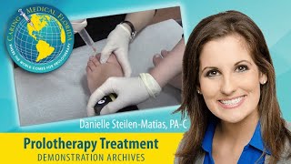 One minute Mortons Neuroma treatment with Prolotherapy [upl. by Alien590]