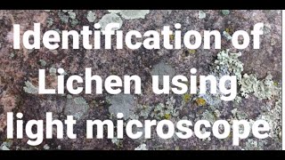 Identification of Lichen using Light microscope [upl. by Mcnully]