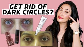 Home remedies to remove dark circles QUICKLY and NATURALLY [upl. by Bartram]