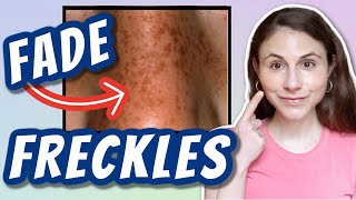 HOW TO FADE FRECKLES Dr Dray [upl. by Proudman578]