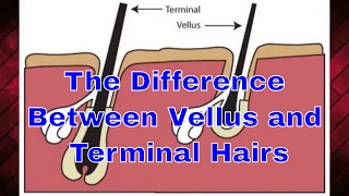 The Difference Between Vellus and Terminal Hairs  TheBeardnecessities  Ep 33 [upl. by Dysart]