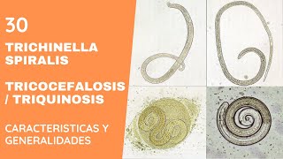 TRICHINELLA SPIRALIS 30  TRIQUINELOSIS  NEMATODOS [upl. by Vale226]