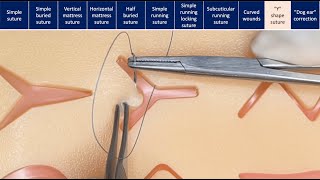 Suturing techniques [upl. by Halyk140]