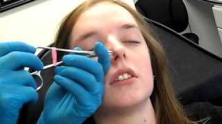 Double Nostril Piercing 2 in 1 sitting [upl. by Lathan]