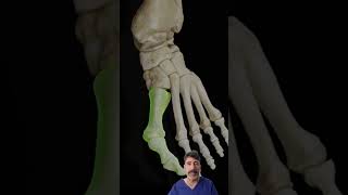 ¿Que es un JUANETE o HALLUX VALGUS dolor fisiolution juanetes dolorpies [upl. by Laeria]