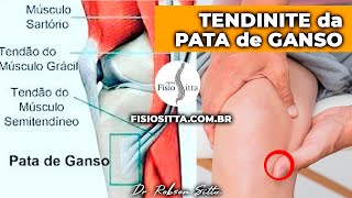 JOELHO TENDINITE DA PATA DE GANSO CAUSAS E TRATAMENTO DE FISIOTERAPIA Dr Robson Sitta [upl. by Lazes]