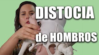 Emergencias obstétricas  DISTOCIA DE HOMBROS [upl. by Jackie]