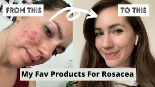 Rosacea Skincare Routine  These Products Changed My Life  Korean Skincare [upl. by Anaderol]