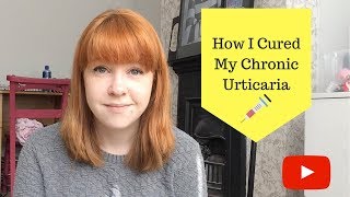 How I cured my Chronic Urticaria [upl. by Kuebbing]