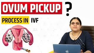 Egg Retrieval Process in Ivf Ovum Pickup in Ivf Egg Pick Up Egg Pickup in Ivf [upl. by Annekahs]