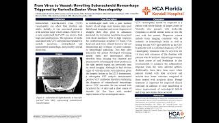 From Virus to Vessel Subarachnoid Hemorrhage Triggered by VaricellaZoster Virus Vasculopathy [upl. by Yug]