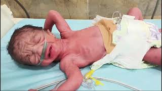 Low Birth Weight of Baby Now Baby age is 10 Days Please pray for This [upl. by Oimetra822]