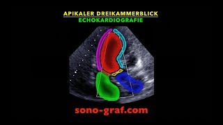 Echokardiografie  Apikaler Dreikammerblick [upl. by Noir]