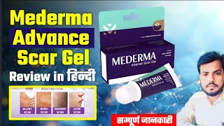 Mederma cream  mederma for acne scars  mederma advanced scar gel review Usesside effects [upl. by Crosse]