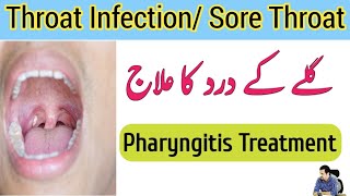 Throat Infection Treatment In Urdu Hindi  Throat Pain  Gale Ka Dard Kaise Thik Kare  Irfan Azeem [upl. by Tesil]