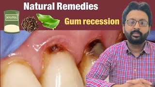 Grow Back Receding Gums Naturally [upl. by Wixted]