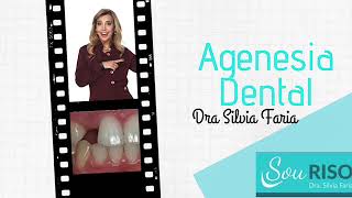 Agenesia dental Quais as consequências a nível de saúde [upl. by Rankin682]