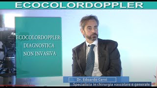 ECOCOLORDOPPLER lesame che scova linsufficienza venosa di arterie vene e capillari [upl. by Htrahddis]