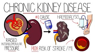 Understanding Chronic Kidney Disease CKD [upl. by Laverne645]