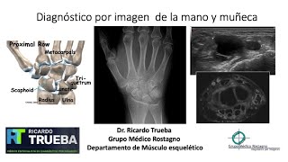 DIAGNOSTICO POR IMAGENES DE LA MANO Y MUÑECA [upl. by Annej101]