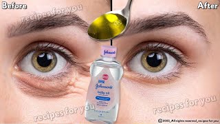 In 3 days Remove Under Eye Bags Completely  Remove Dark Circles Wrinkles and Puffy Eyes [upl. by Sirah]