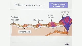 Overview of Gynecologic Cancers [upl. by Kutzer694]