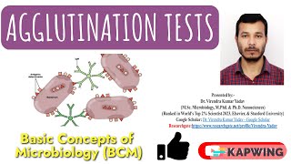 Agglutination tests I Immunology I Hemagglutination tests I Hemagglutination Inhibition tests I [upl. by Segroeg]