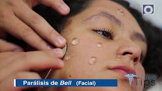 FisioTips Parálisis Facial [upl. by Yks113]