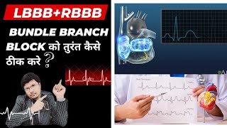 RBBBLBBB से होता है जोखमइन बातो का रखे ध्यानEffect of BUNDLE BRANCH BLOCK ON PROGNOSISTREATMENT [upl. by Atiuqehc]