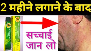 Chloasma Care Cream की सच्चाई  2 महीने लगाने के बाद मेरा अनुभव  UsefullProducts [upl. by Nabalas]