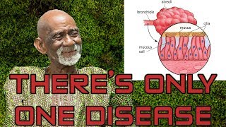 Dr Sebi Reveals Herbs For Mucus Removal [upl. by Lebiram287]