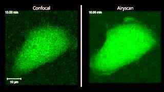 ZEISS LSM 880 Kinetochore movement with Airyscan [upl. by Medor]