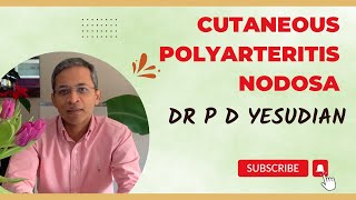 Cutaneous polyarteritis nodosa  a comprehensive review Dermatologist explains [upl. by Yahsel]